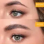 صابونة الحواجب قبل وبعد