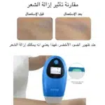 ⁦جهاز ليزر ملاي المنزلي T3 المطور لازالة الشعر - ثلاث عدسات⁩ - الصورة ⁦20⁩